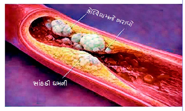 આરોગ્ય એક્સપ્રેસઃ ધ્યાન રહે... વધારે પડતું કેલ્શિયમ પણ આરોગ્ય માટે જોખમી છે!
