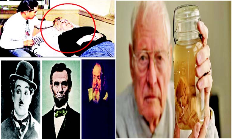 ક્લોઝ અપ: કેમ તફડાવવું પડ્યું એમનું મગજ?