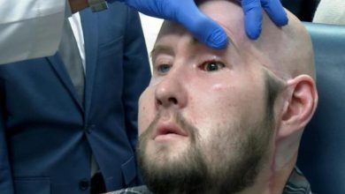 After the tireless work of 140 doctors, the world's first eye