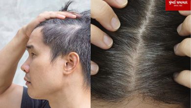 Is your hair also turning gray prematurely? Know the reasons