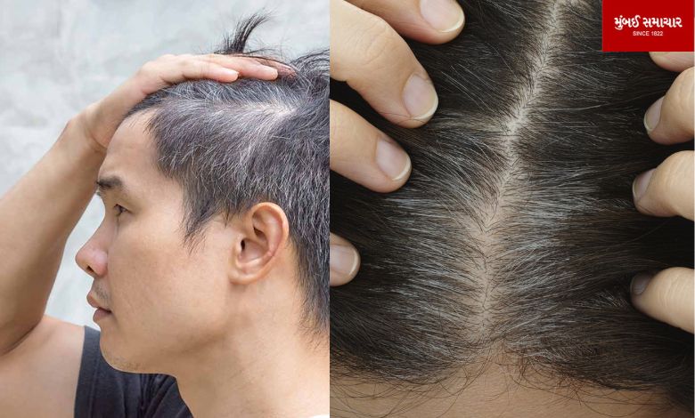 Is your hair also turning gray prematurely? Know the reasons