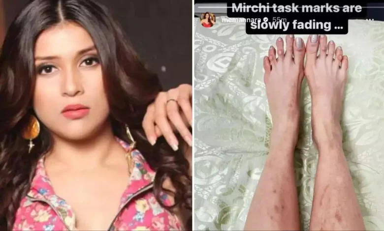 When Mirchi showed the marks of the task, the poor thing got trolled