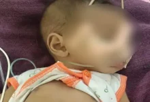 3 month old surendranagar dead
