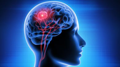 If there is a brain tumor, these changes appear in the body, 90 percent of people ignore it as normal