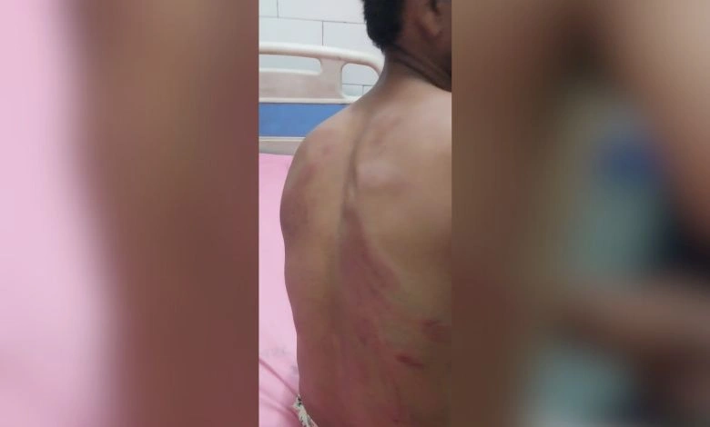 morbi youth beaten suspicion theft