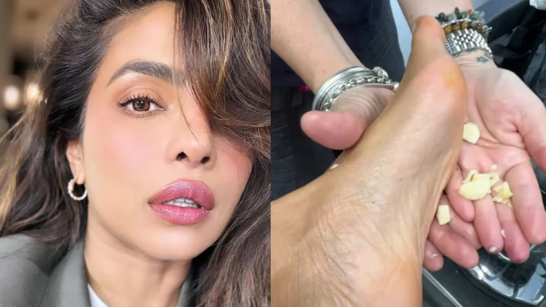 Health tips: This home remedy of Priyanka Chopra has gone viral, you too know the benefits