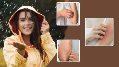 Skin diseases can occur in the rainy season, so take care of your skin