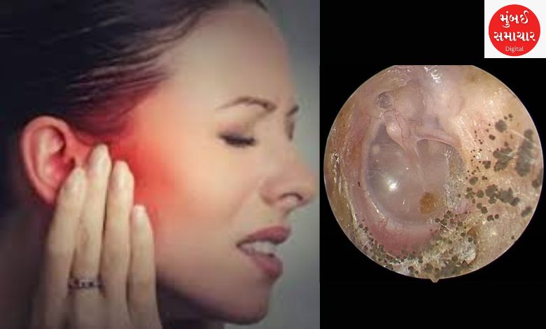 Caution: Cases of ear fungus are increasing in rainy weather