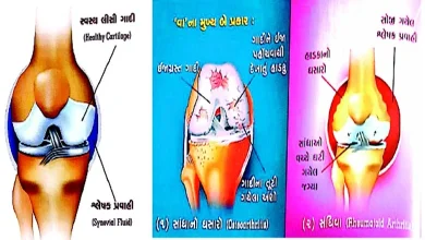 What is bone related disease and its treatment