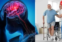 Gujarat reported 9,488 cases of stroke in nine months, with Ahmedabad having the highest number of cases of paralysis-stroke