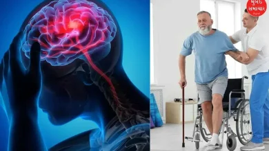 Gujarat reported 9,488 cases of stroke in nine months, with Ahmedabad having the highest number of cases of paralysis-stroke