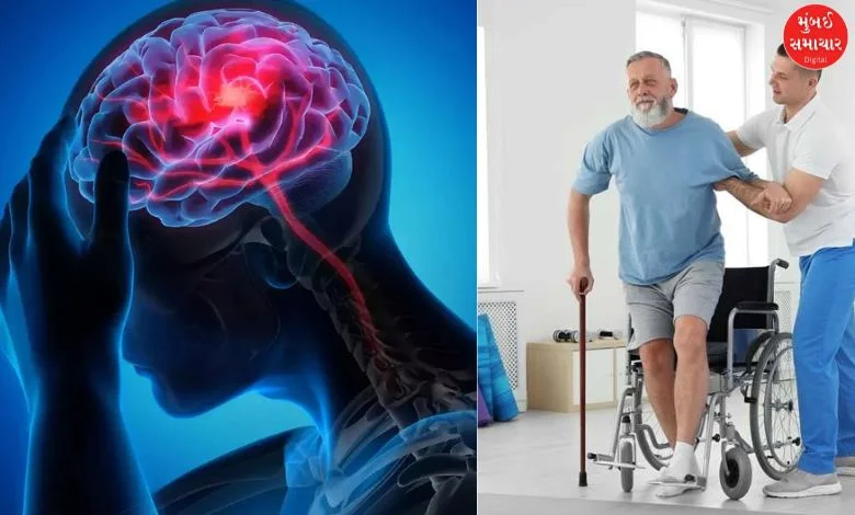 Gujarat reported 9,488 cases of stroke in nine months, with Ahmedabad having the highest number of cases of paralysis-stroke