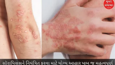 Psoriasis sufferers should not eat this food by mistake, otherwise