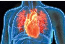 What is the difference between heart-attack and cardiac arrest?