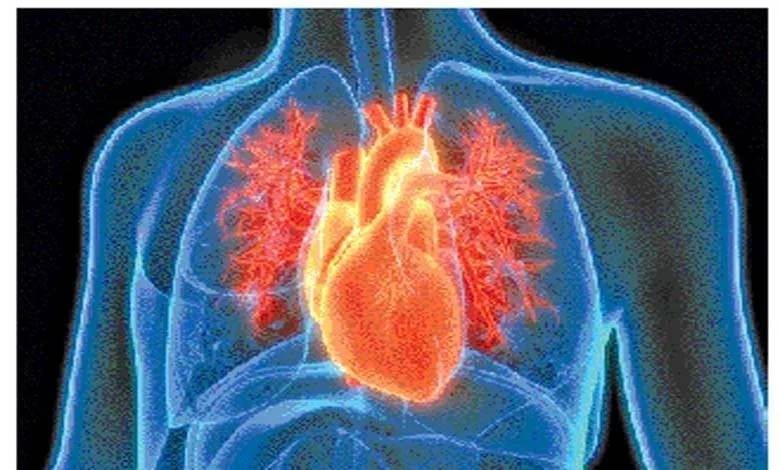 What is the difference between heart-attack and cardiac arrest?