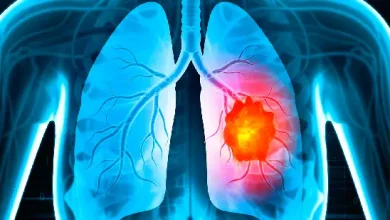 Lifestyle: Whether you have lung cancer or not, do the test at home like this...