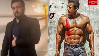 Every bone has a fracture Salman Khan