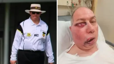 Umpire injured on face in a batter's shot