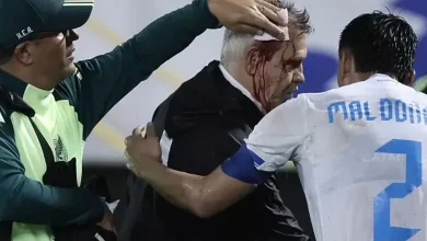 After the football match, the coach of the defeated Mexican team was subjected to such...