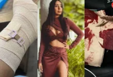 Bollywood actress meets with terrible accident, gives information on social media