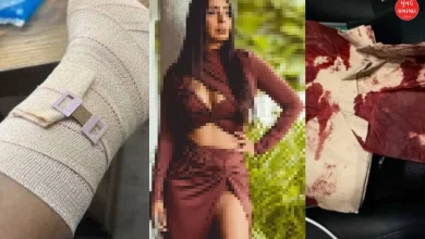 Bollywood actress meets with terrible accident, gives information on social media