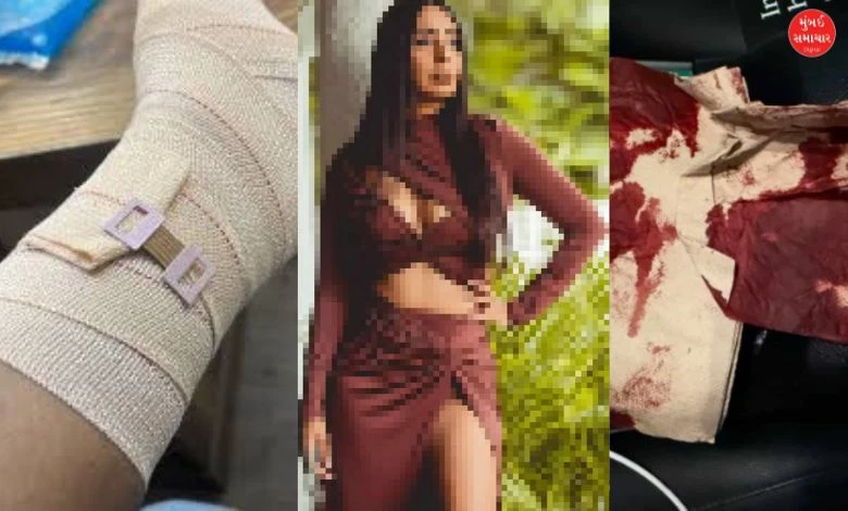 Bollywood histrion   meets with unspeakable  accident, gives accusation  connected  societal  media