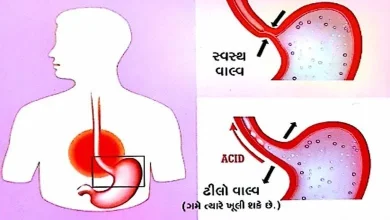 Health Plus These are the symptoms of acidity