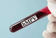 Another case of HMPV virus in Gujarat, 69-year-old woman tests positive