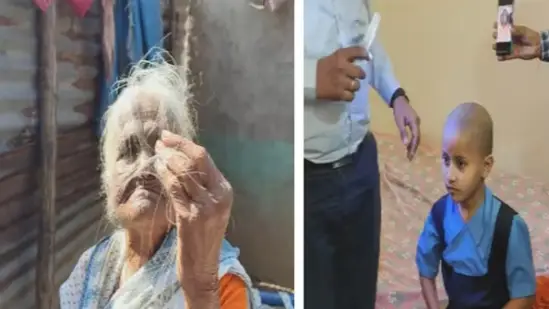 Villagers experiencing hair loss in Buldhana, Maharashtra