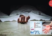 guillain barre syndrome case reported in pune maharashtra