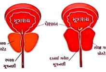 illustration of prostate gland