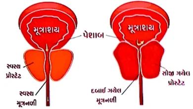 illustration of prostate gland