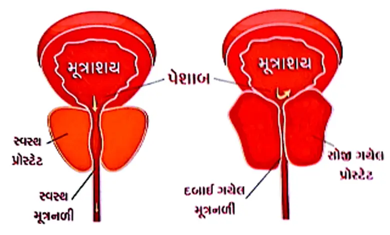 illustration of prostate gland