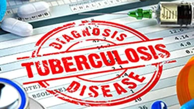 Gujarat government provides Rs 1000 aid to treatment of Tuberculosis