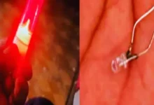 Four-year-old girl swallows LED light along with chocolate...