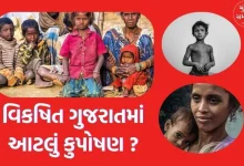 Shame of prosperous Gujarat: 5.40 lakh children in the state are malnourished