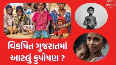 Shame of prosperous Gujarat: 5.40 lakh children in the state are malnourished