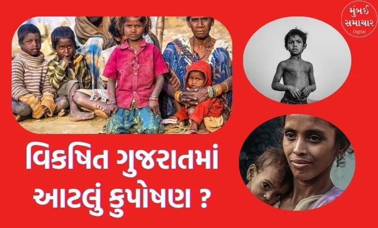 Shame of prosperous Gujarat: 5.40 lakh children in the state are malnourished