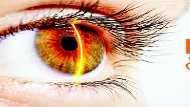 "Diabetes and Eye Problems: Causes, Symptoms, and Prevention"