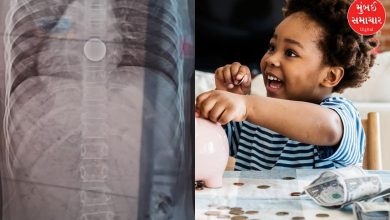 A 10-year-old girl swallowed a coin in Valsad, her life was saved, parents beware!
