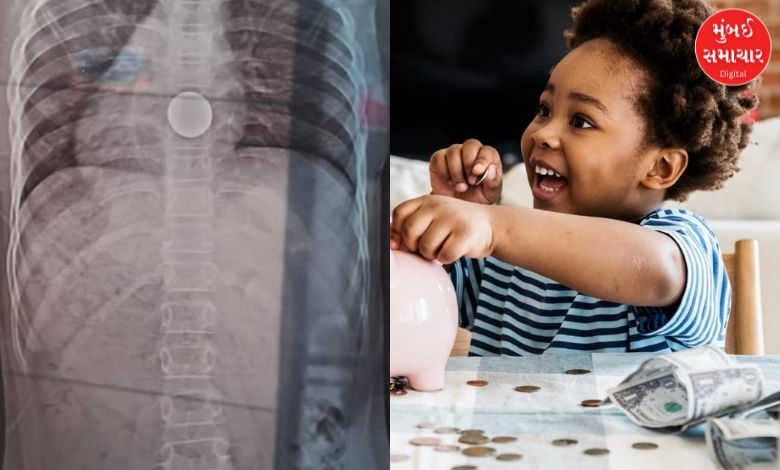 A 10-year-old girl swallowed a coin in Valsad, her life was saved, parents beware!