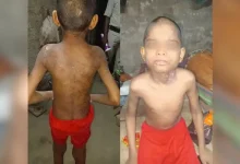 રાજકોટ 19 બંગાળી બાળમજૂર