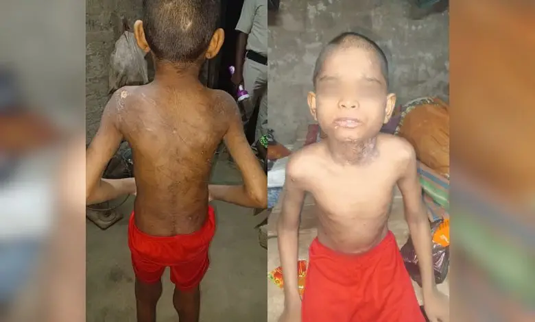 રાજકોટ 19 બંગાળી બાળમજૂર