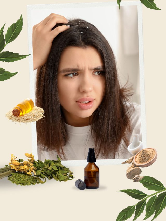 ડેંડ્રફ, ડ્રાઈનેસ, હેરફોલ, સમસ્યા અનેક ઈલાજ એક