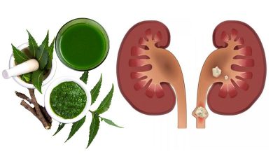 આ ઔષધિ તમારી પથરીને જડમૂળથી દૂર કરશે