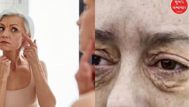 Beware! These symptoms on your face may be signs of heart disease