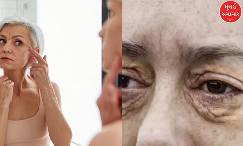 Beware! These symptoms on your face may be signs of heart disease
