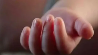 10-day-old baby girl scalded with hot rod