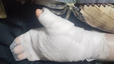 Teacher crosses all limits! Burns 8-year-old's hand for bad handwriting