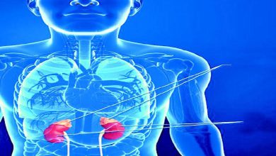 આરોગ્ય એક્સપ્રેસ : છુપા રુસ્તમ જેવો આ એડિસન રોગ શું છે?